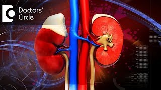 What is Prerenal amp Postrenal Acute Kidney Injury What is Uremic Syndrome  Dr Manoharan B [upl. by Fokos]