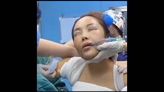 Facelifting 😱 beauty facelift transformation shwechuukoreaskincareandcosmetics [upl. by Danyette722]