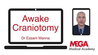 Awake Craniotomy 1 [upl. by Lodhia]