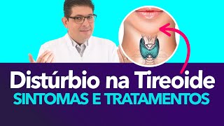 Distúrbios da tireoide sintomas e tratamentos  Dr Juliano Teles [upl. by Temme]