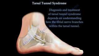 Tarsal Tunnel Syndrome  Everything You Need To Know  Dr Nabil Ebraheim [upl. by Siradal216]