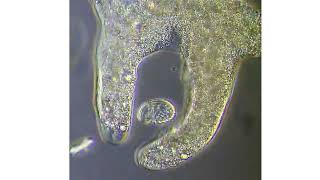 nutrition in amoeba  real under microscopic view  digestion absorption  excretion [upl. by Alleen]