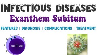 Exanthem Subitum  Viral Infections  Infectious Diseases 4  Medicine [upl. by Barnett]