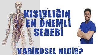 Varikosel Nedir ve Neden Olur [upl. by Ardnasac]