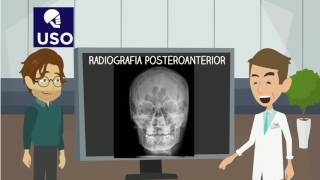 Rx Posteroanterior [upl. by Romanas]