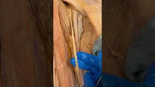 Real Femoral Artery amp Nerve [upl. by Eiuqcaj]