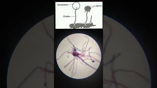 Rhizopus slide under MicroscopeMicroorganism [upl. by Meir]