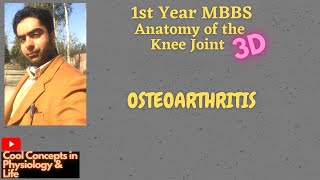 3D Anatomy Knee joint  Clinical Scenario  OSTEOARTHRITIS 1st year MBBS [upl. by Nissa]