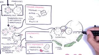 Systemic Lupus Erythematosus SLE  signs and symptoms pathophysiology investigations treatment [upl. by Clotilde]