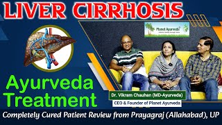 Liver Cirrhosis Ayurveda Treatment  Completely Cured Patient Review from Prayagraj Allahabad UP [upl. by Atika172]