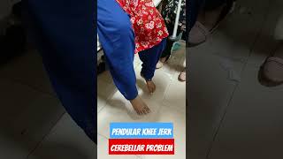 Pendular Knee jerk in cerebellum lesiondiseasediagnosiscerebellum [upl. by Freyah794]