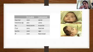 Microcephaly and Macrocephaly  Dr Deblina [upl. by Vogel]