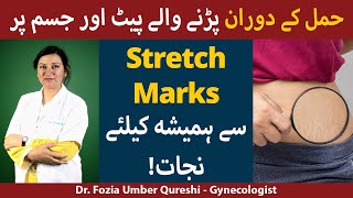 How to Prevent and Treat Stretch Marks During Pregnancy [upl. by Aihsital508]