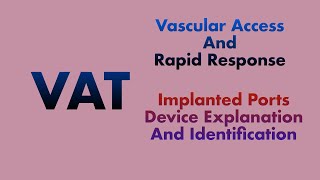 Implanted Ports Device Explanation and identification [upl. by Verile732]