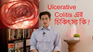 What is ulcerative colitis Ulcerative colotis কি [upl. by Namrej]