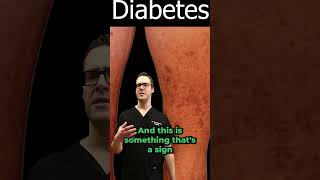 Diabetic Dermopathy Pictures amp Treatment Diabetes Symptoms amp Signs [upl. by Rodgers149]