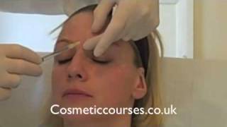 Botox training 3 Botox injection demonstration  Cosmetic Courses [upl. by Eirrod]