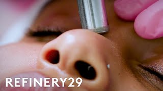 What Microdermabrasion Looks Like Up Close  Macro Beauty  Refinery29 [upl. by Osnofedli]