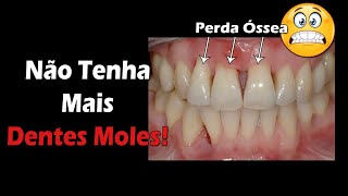 Não Tenha Mais Dentes Moles  3 Dicas FÁCEIS E RÁPIDAS  Periodontite Tem Cura [upl. by Carol-Jean337]