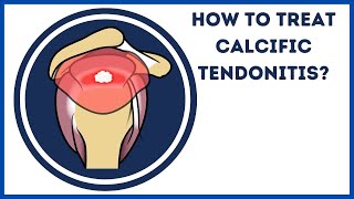 How to treat calcific tendonitis [upl. by Namso]