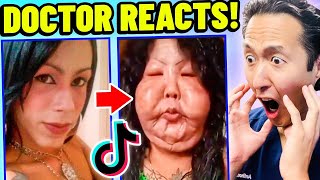 Plastic Surgeon Reacts to EXTREME Plastic Surgery TikTok Videos [upl. by Alexi355]