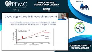 Doença Arterial Coronariana Crônica [upl. by Eiramik]