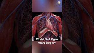 World First Open Heart Surgery In Islam shorts [upl. by Jamila]