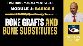 Hand Fractures Basics 6  Bone grafts and Bone substitutes  Properties use and salient features [upl. by Thirzia449]