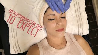 Microdermabrasion 101 What to expect [upl. by Nnylyram834]