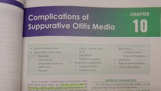 Complications of Suppurative Otitis Media  ENT [upl. by Sundin]