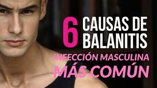 6 Causas de Balanitis  la infección masculina más común 👨‍⚕️ [upl. by Putscher808]