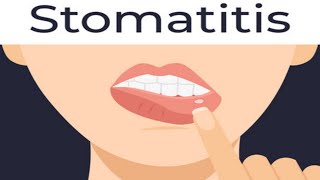 stomatitiscauses of stomatitissymptoms of stomatitisshort [upl. by Notsniw]