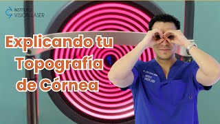 EXPLICANDO TU TOPOGRAFIA DE CORNEA [upl. by Jamil]