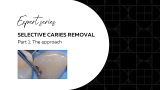 Selective Carious tissue removal the approach  Deppelers Expert series  Restoration [upl. by Narine]