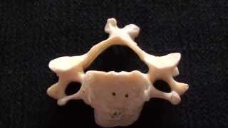 Cervical Vertebrae  Typical cervical vertebrae  Anatomy [upl. by Atteram133]