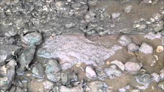 Canal Wall Doctor Explains Issues with Canal Wall Constuction Joints [upl. by Lindberg262]