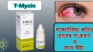 Tmycin ointment Tobramycin 03  Eye Drops  চোখ উঠা [upl. by Nikolaus70]