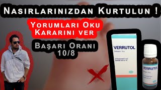 Nasırı Verrutol Yöntemiyle Geçirme \u00100 Çözüm [upl. by Letnuahs]