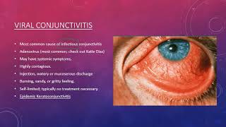 Conjunctivitis [upl. by Knipe]