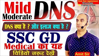 SSC GD 2024  DNS क्या है   ssc gd me dns kaise check hota hai  ssc gd medical dns surgery [upl. by Ahsata]