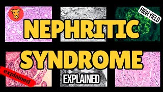 NEPHRITIC SYNDROME Pathogenesis of glomerular injury Mechanism of clinical symptoms USMLE Nephrology [upl. by Ettenil]