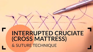 Interrupted Cruciate Cross Mattress Suture Technique [upl. by Bast]