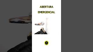 quotABERTURA EMERGENCIAL DE RESIDÊNCIAquot [upl. by Assirhc]