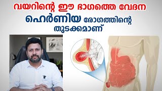 വയറിന്റെ ഈ ഭാഗത്തെ വേദന ഹെർണിയ രോഗത്തിന്റെ തുടക്കമാണ്  Hernia Treatment  Dr Antony Chacko [upl. by Molohs587]