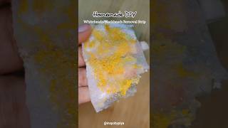 WhiteheadsBlackheads Removal Stripskincareskincareroutineskincaretipsskincarereviewbeautytips [upl. by Morganne]