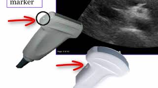 Introduction to Radiology Ultrasound [upl. by Ruff]