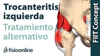 Trocanteritis izquierda  Visión desde la fisioterapia y la medicina natural [upl. by Ecirahs]