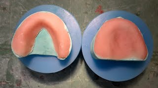 How to make edentulous cast and how to make denture base [upl. by Irrak]