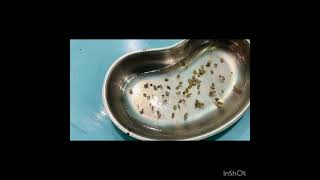 Ectoparasites Ticks in Dog 🐕 [upl. by Otrebor]