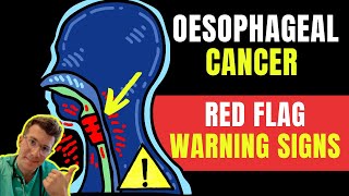 Warning signs amp symptoms of OESOPHAGEALAKA esophageal gullet CANCER  Doctor ODonovan explains [upl. by Trixie694]